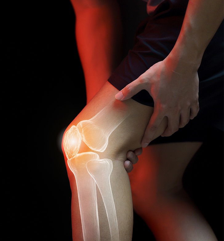 Adolescent Sports Injuries of the Knee