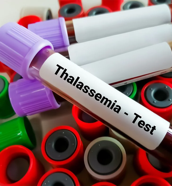 Beta Thalassemia