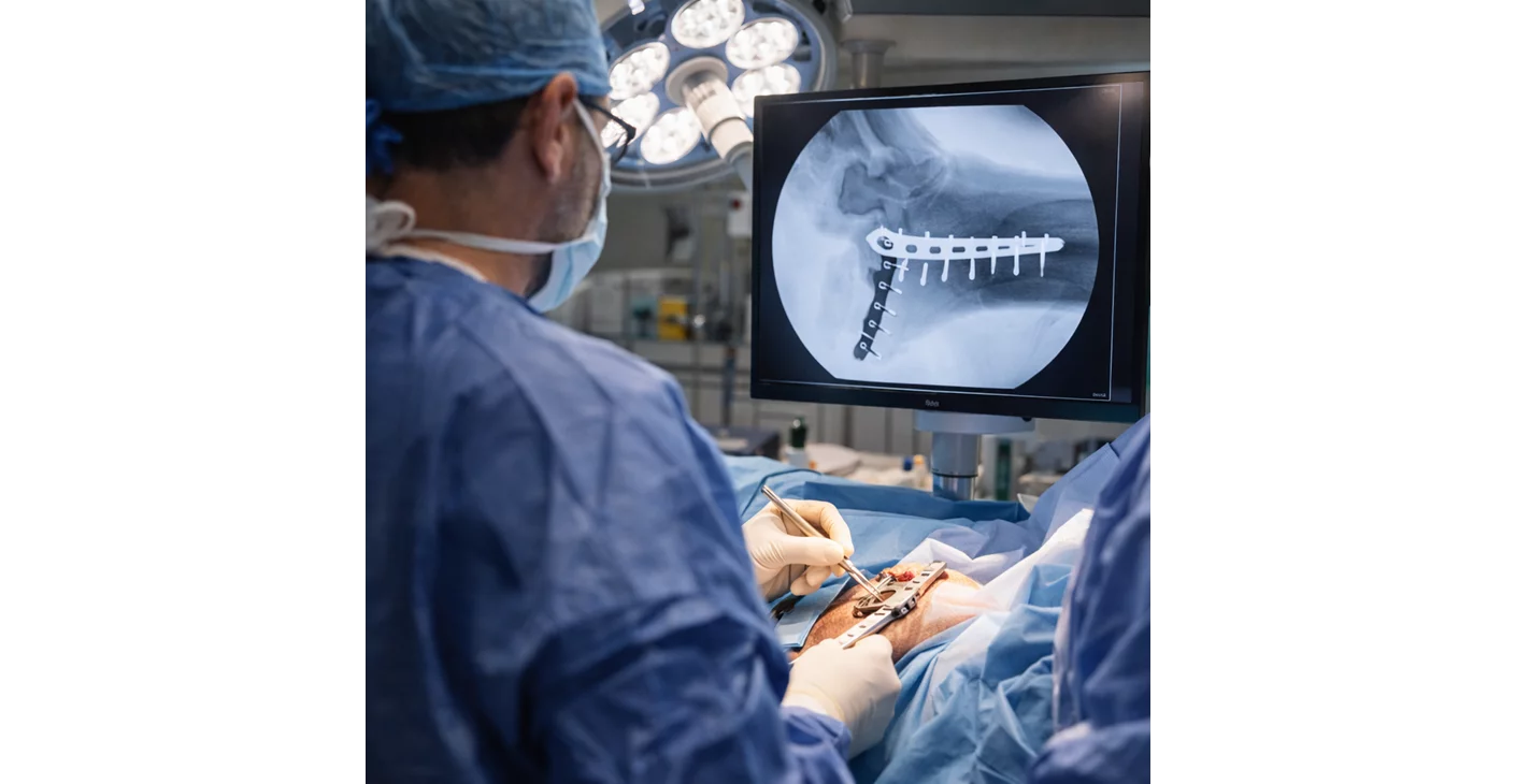 جراحة الكسور المعقدة