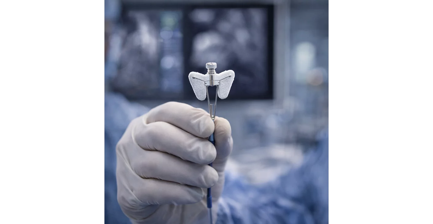 إجراء إصلاح الصمام الميترالي بالقسطرة